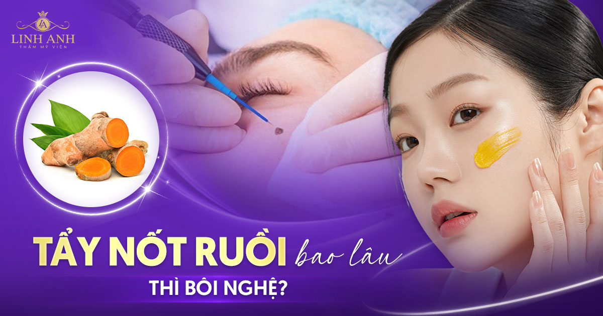 Tẩy nốt ruồi bao lâu thì bôi nghệ