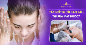 Tẩy nốt ruồi bao lâu thì rửa mặt