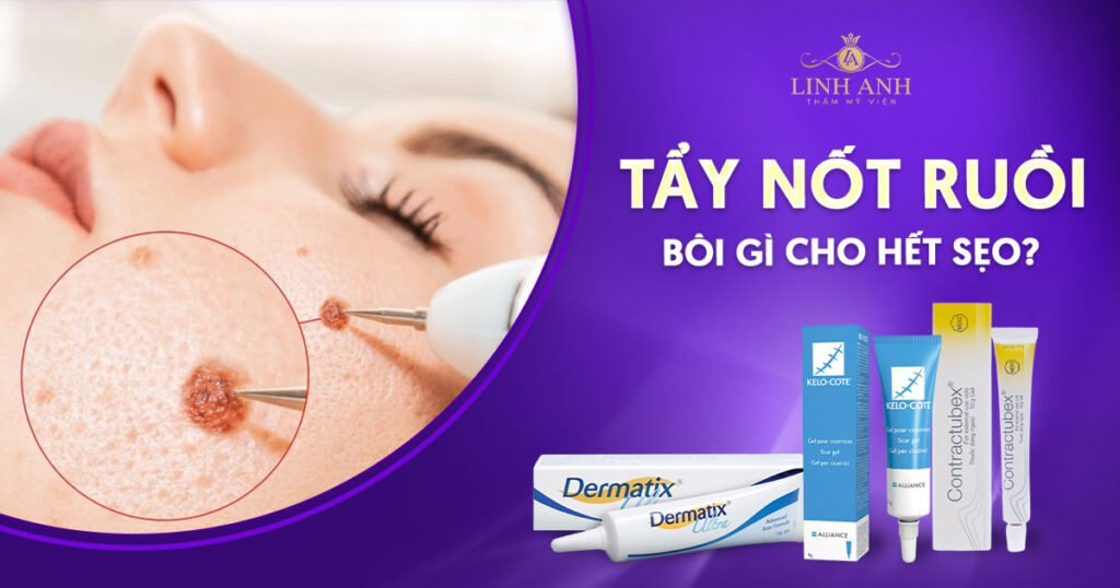 Tẩy nốt ruồi bôi gì cho hết sẹo