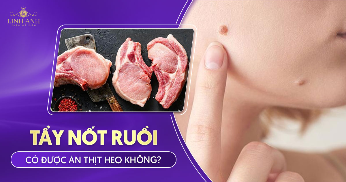 Tẩy nốt ruồi có được ăn thịt heo không
