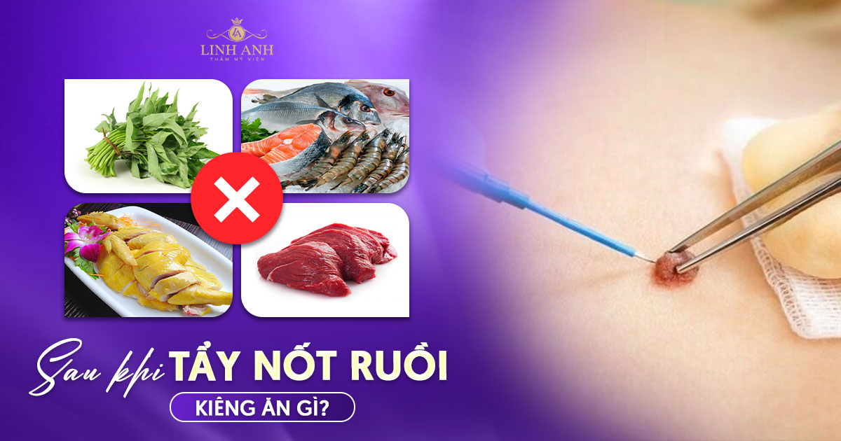 Tẩy nốt ruồi kiêng ăn gì