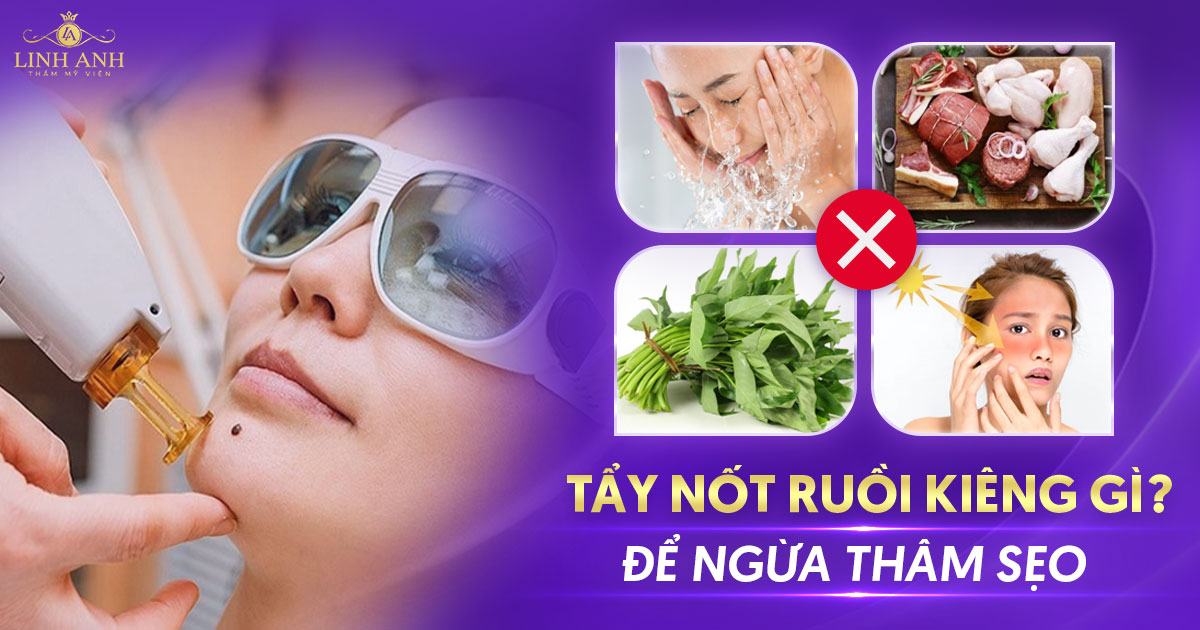 Tẩy nốt ruồi kiêng gì