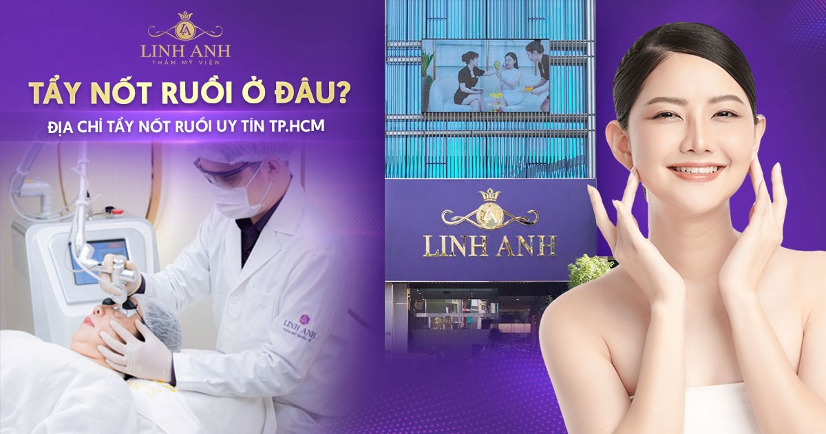 Tẩy nốt ruồi ở đâu