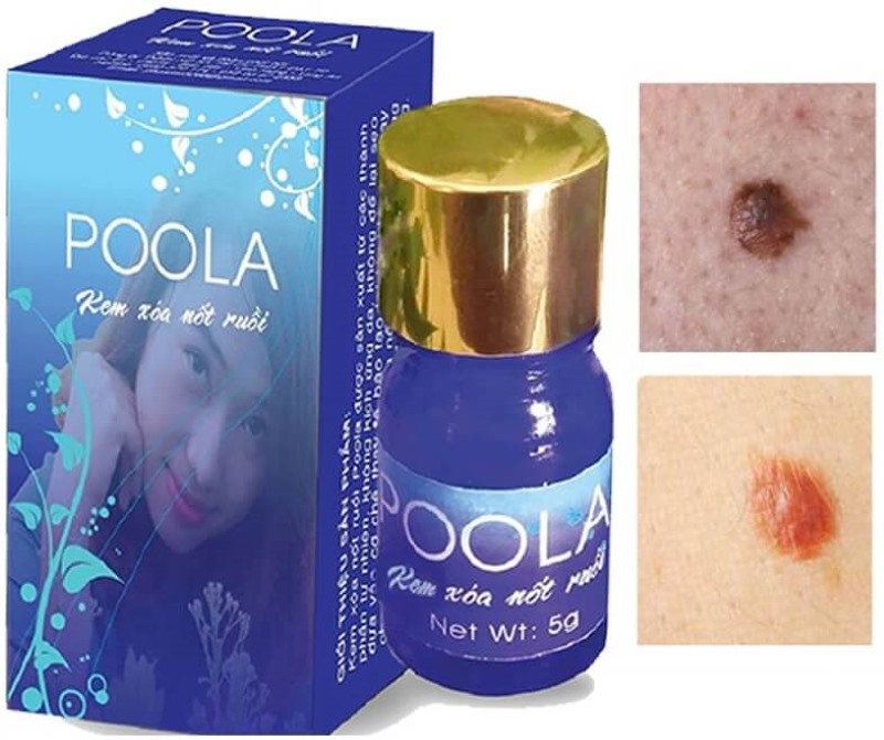Thuốc tẩy nốt ruồi Poola