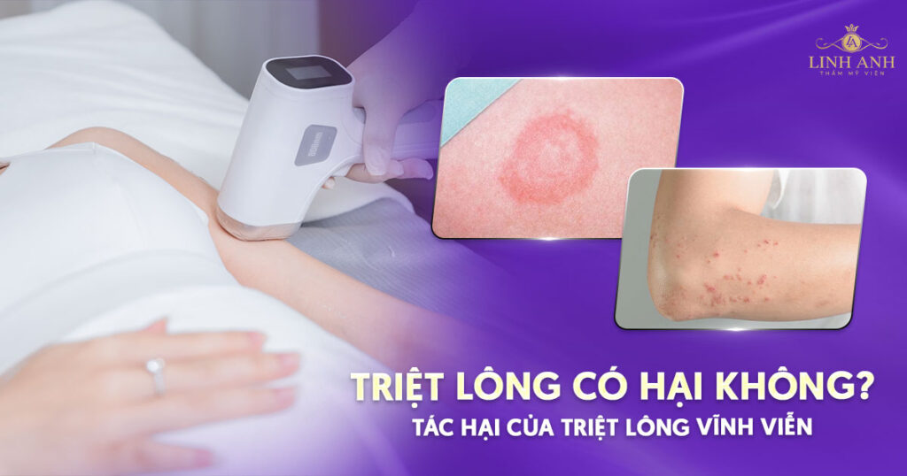 Triệt lông có hại không