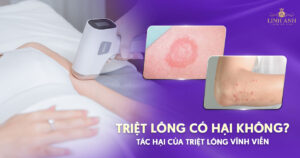Triệt lông có hại không