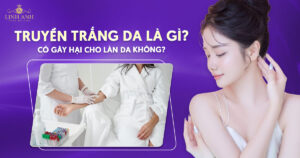 Truyền trắng