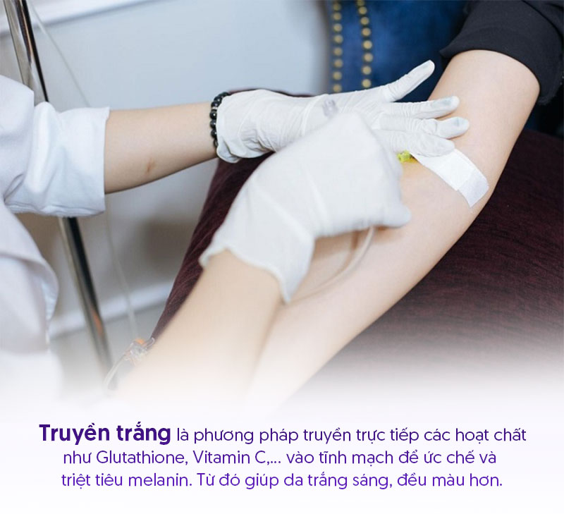 Truyền trắng da là gì Truyền trắng da là gì