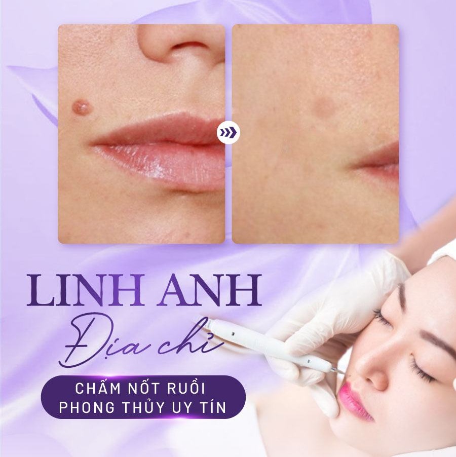 tử vi nốt ruồi trên cơ thể nữ phú quý tử vi nốt ruồi trên cơ thể nữ phú quý