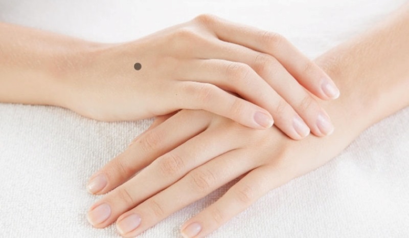 Vị trí nốt ruồi trên mu bàn tay