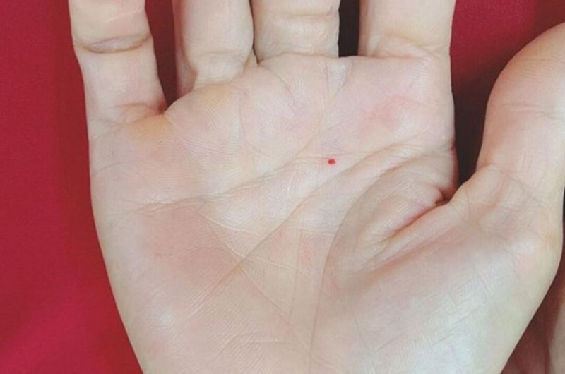 Xem nốt ruồi son trong lòng bàn tay trái nữ