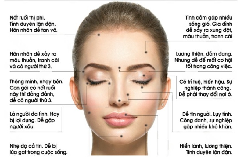 Xoá nốt ruồi có thay đổi vận mệnh không