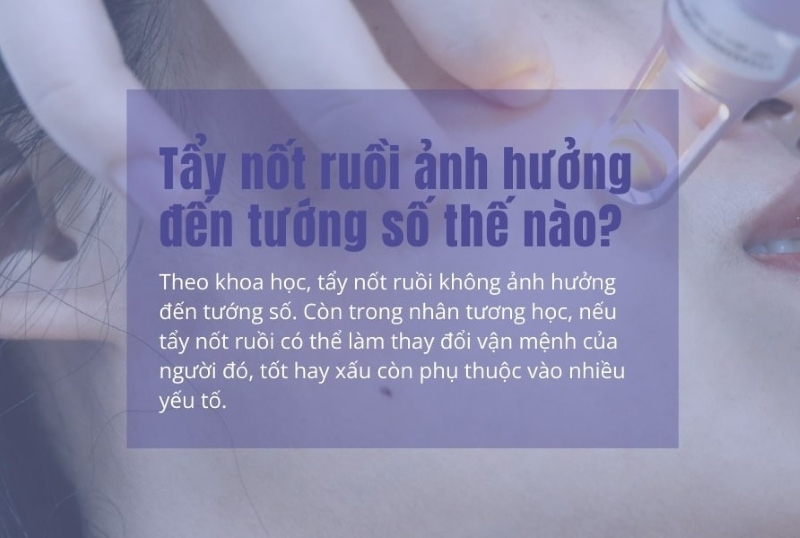 Xóa nốt ruồi có thay đổi vận mệnh