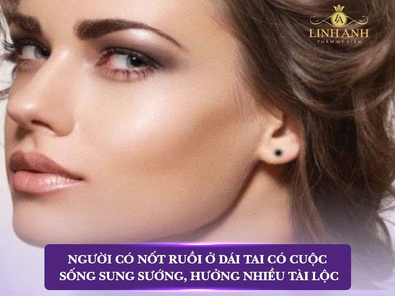 Ý nghĩa nốt ruồi dái tai