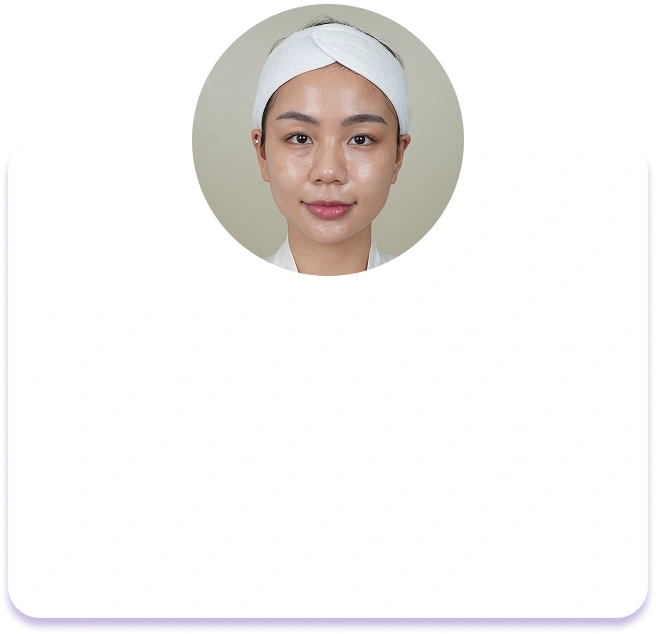 Lông mày thưa, nhạt màu, không có khuôn