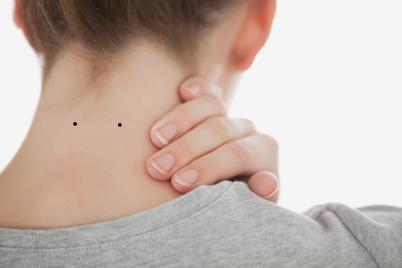 2 nốt ruồi thẳng hàng trên cổ sau gáy