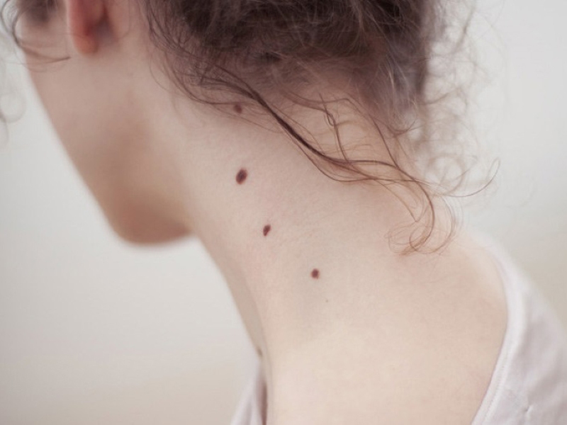 3 nốt ruồi nằm trên cổ