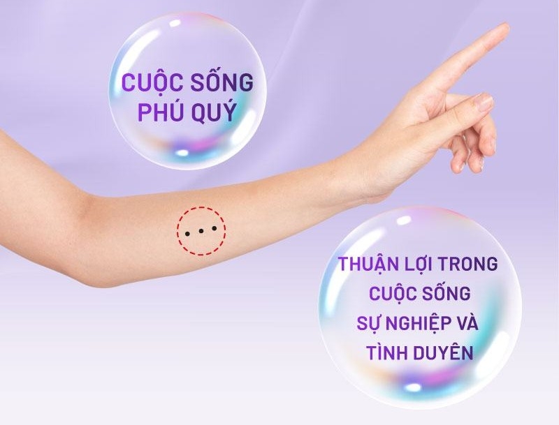 3 Nốt ruồi thẳng hàng trên tay