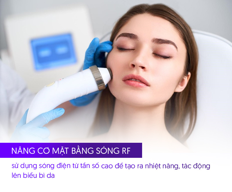 Công nghệ RF