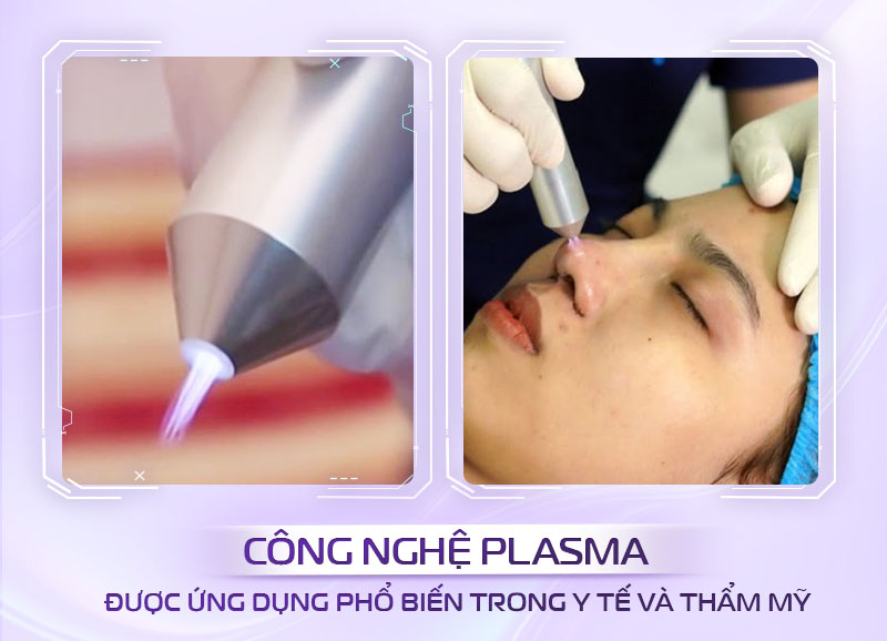 Công nghệ plasma