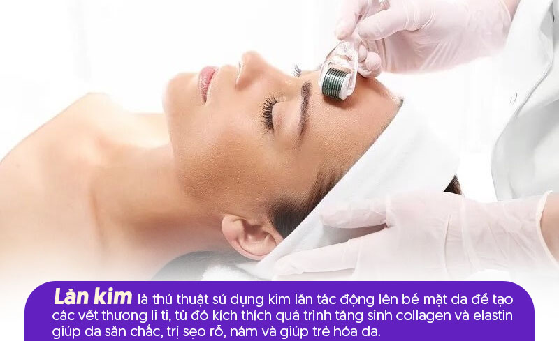 Lăn kim là gì
