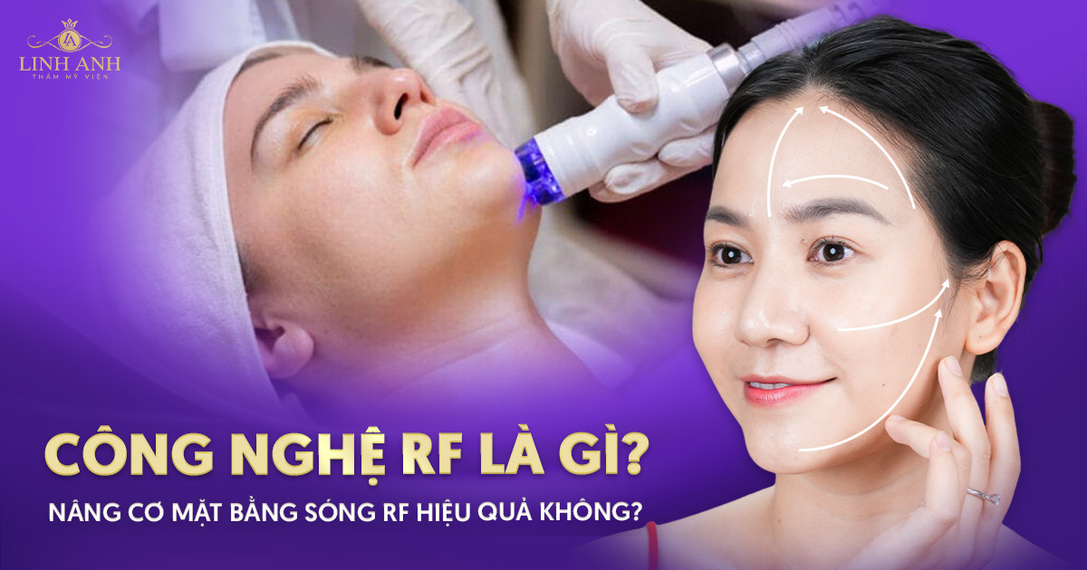 Công nghệ RF là gì? Nâng cơ mặt bằng sóng RF hiệu quả không?