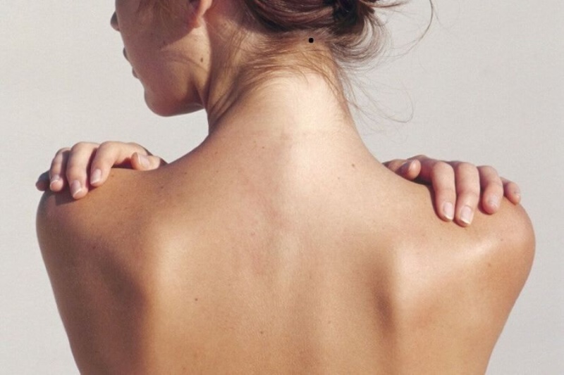 Nốt ruồi sau gáy nằm trong tóc Nốt ruồi sau gáy nằm trong tóc