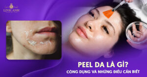 Peel da