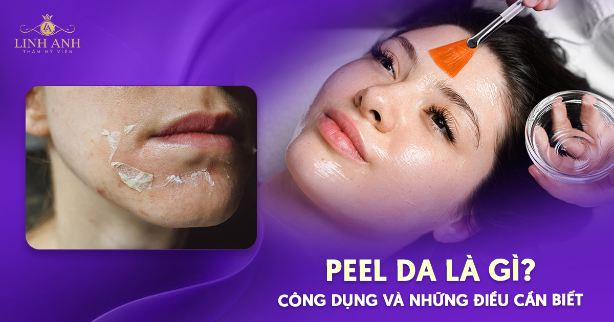 Peel da là gì? Công dụng và những điều cần biết