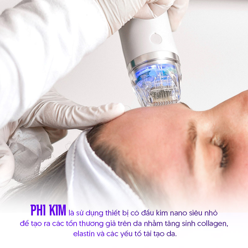 Phi kim tế bào gốc là gì