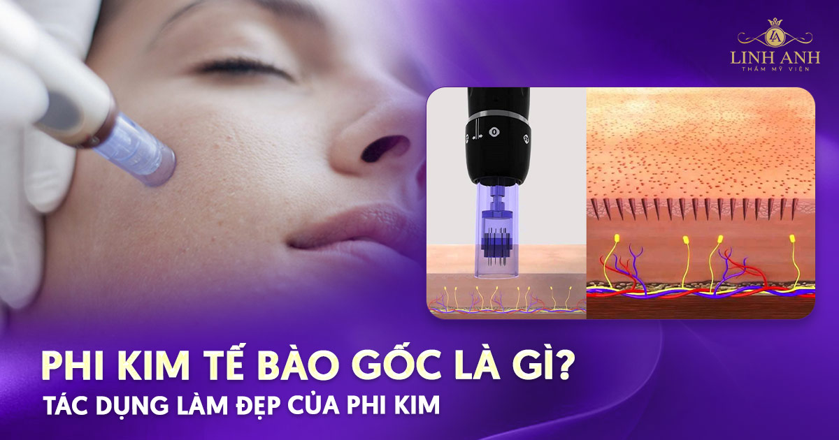 Phi kim tế bào gốc là gì? Tác dụng làm đẹp của phi kim