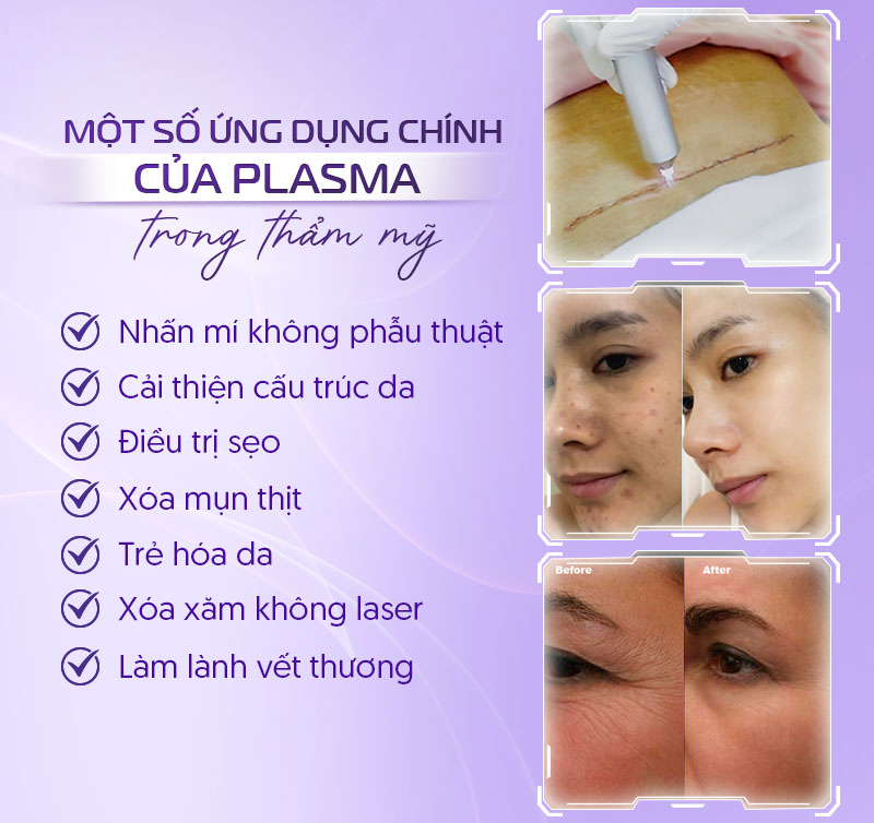 Plasma trong lĩnh vực thẩm mỹ