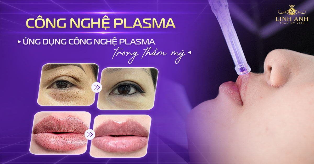 Công nghệ Plasma là gì? Ứng dụng công nghệ plasma trong thẩm mỹ