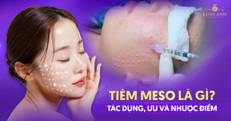 Tiêm meso là gì? Tác dụng, ưu và nhược điểm