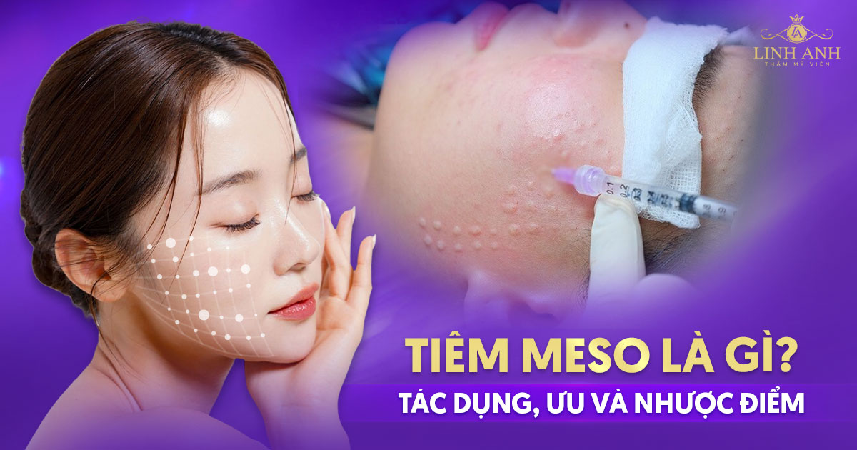 Tiêm meso là gì? Tác dụng, ưu và nhược điểm