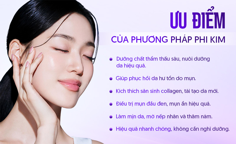 Ưu điểm khi thực hiện phi kim
