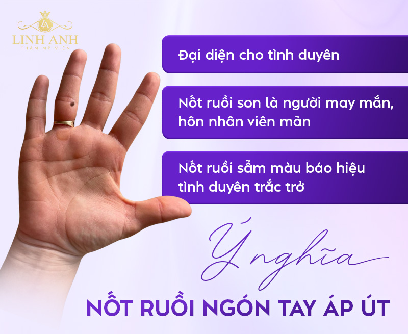 Ý nghĩa nốt ruồi ngón tay áp út Ý nghĩa nốt ruồi ngón tay áp út