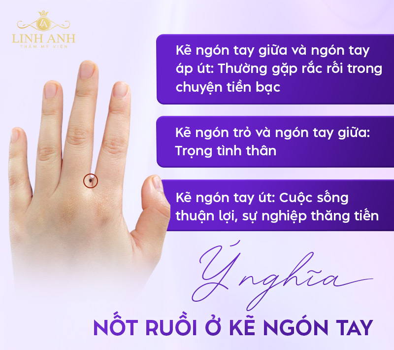 Ý nghĩa nốt ruồi ở kẽ ngón tay Ý nghĩa nốt ruồi ở kẽ ngón tay