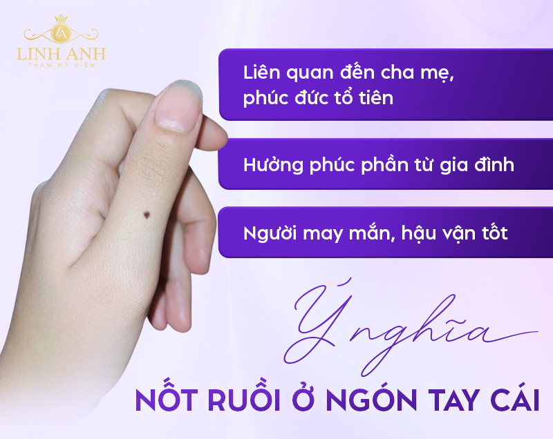 Ý nghĩa nốt ruồi ở ngón tay cái Ý nghĩa nốt ruồi ở ngón tay cái