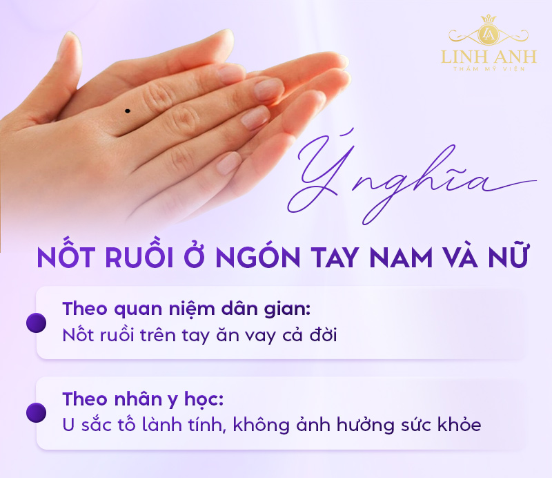 Ý nghĩa nốt ruồi ở ngón tay nam và nữ Ý nghĩa nốt ruồi ở ngón tay nam và nữ