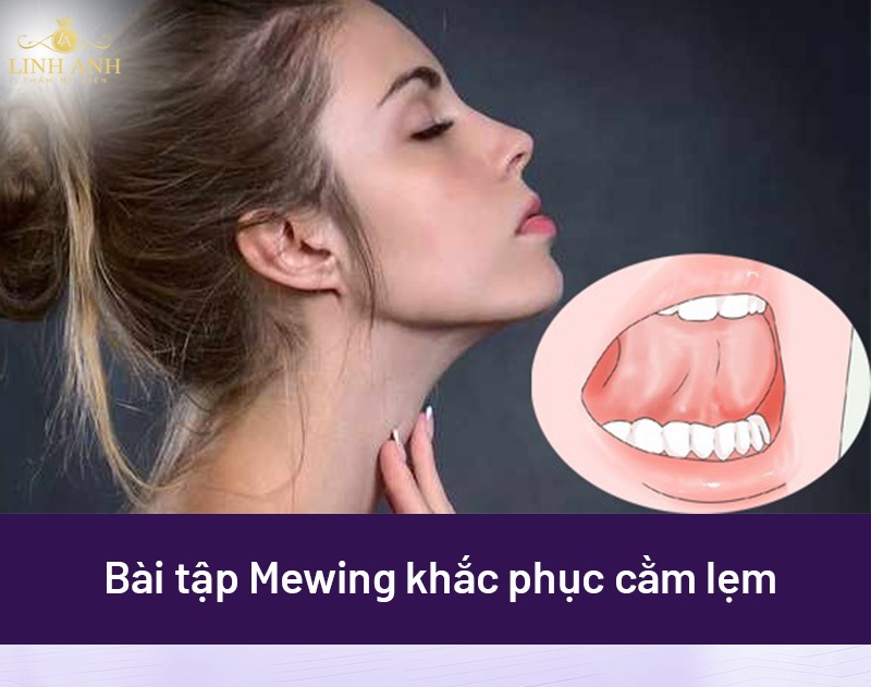 Bài tập chữa cằm lẹm