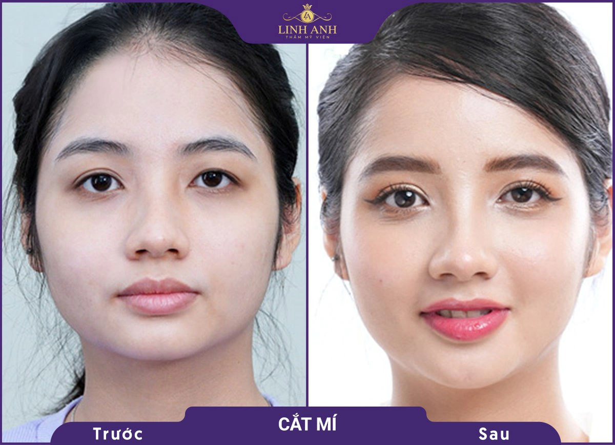 bf af cat mi 4