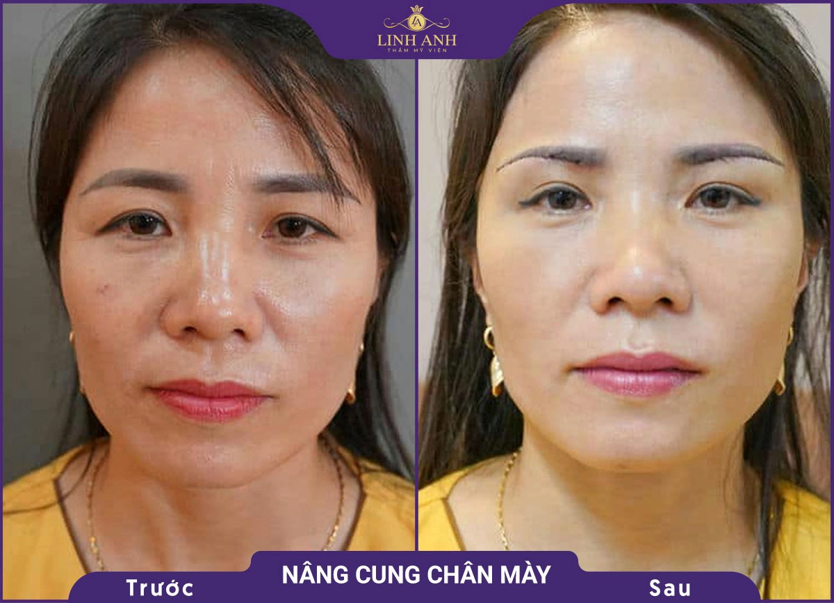 bf af nang cung 1