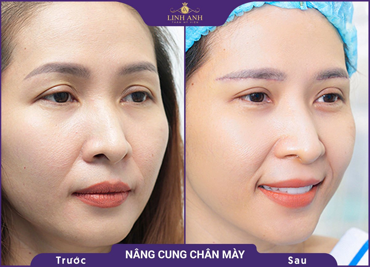 bf af nang cung 5