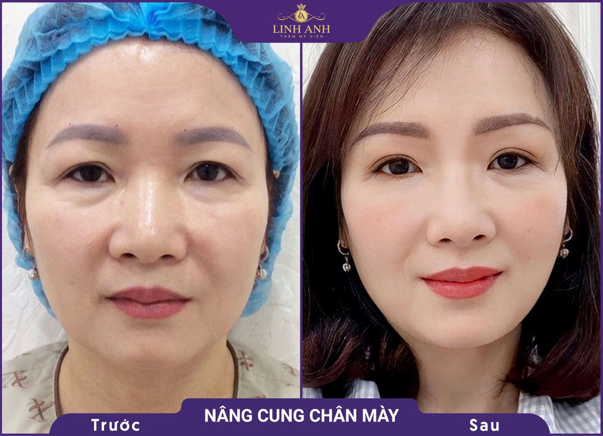 bf af nang cung 6