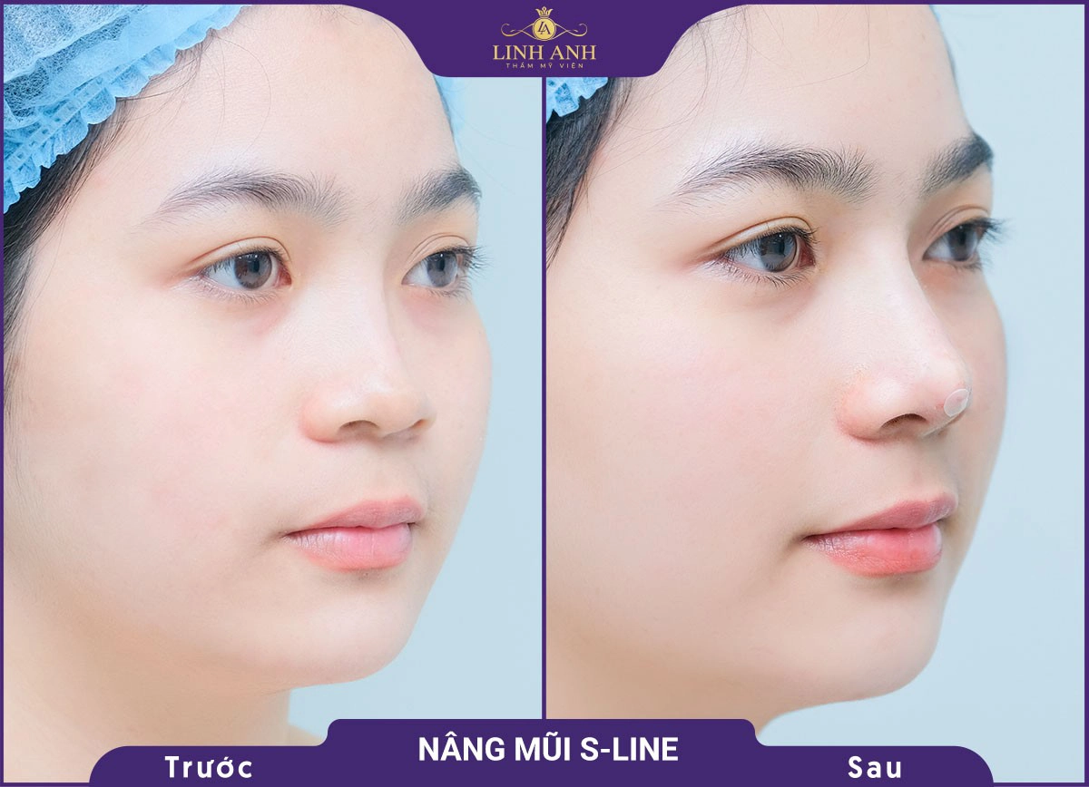 bf af nang mui 1