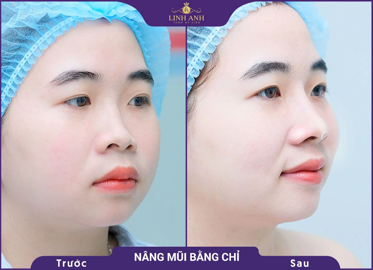 bf af nang mui 2