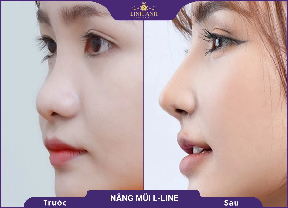 bf af nang mui 3