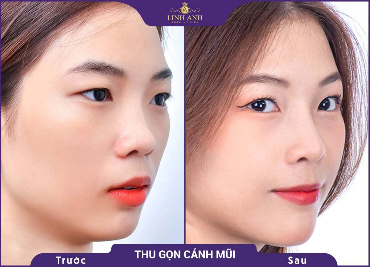 bf af nang mui 4