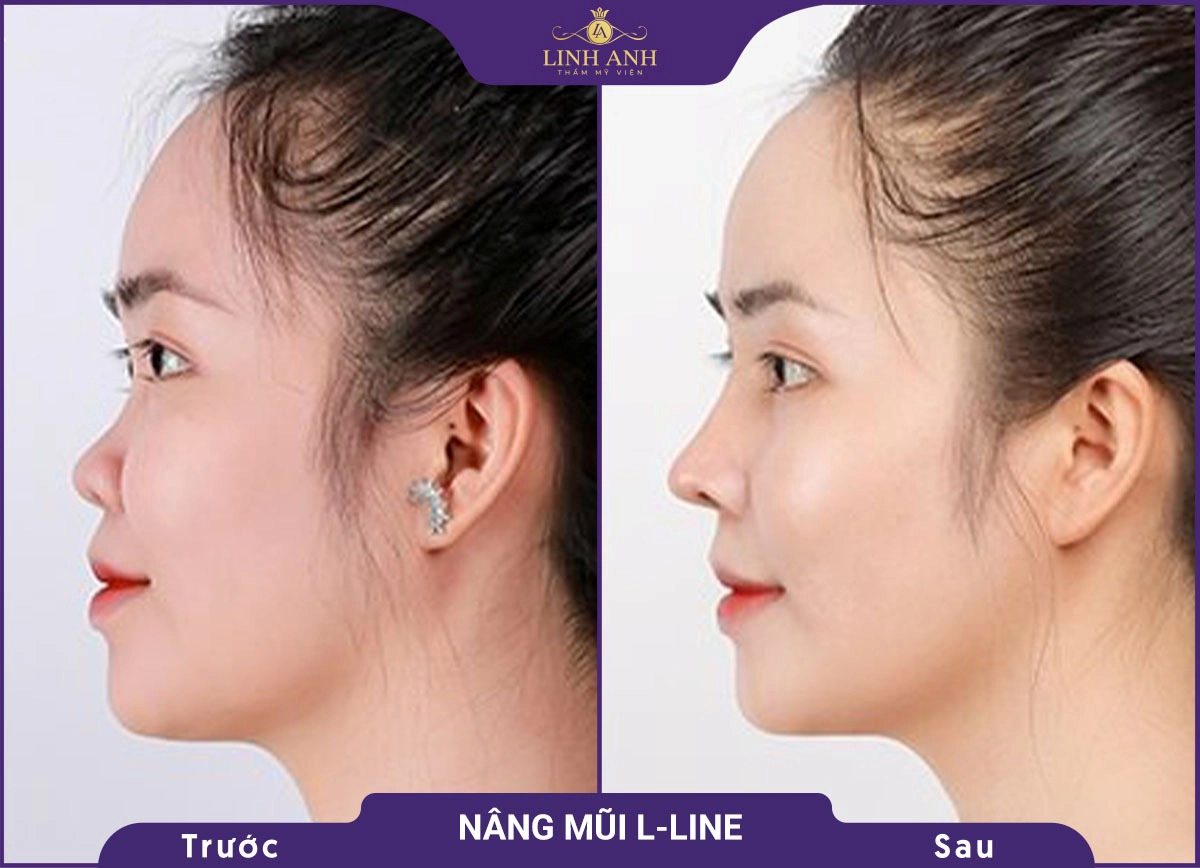 bf af nang mui 5